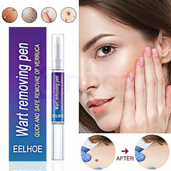 Wart Remover Pen, Skin Treatment, Mole Remover